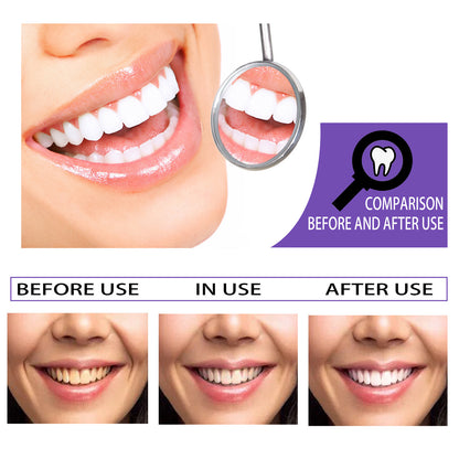 Teeth Whitening Toothpaste for Stain Removal and Brighter Smiles